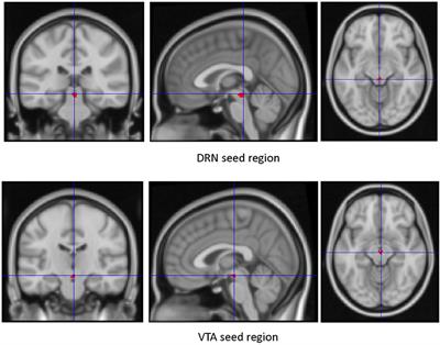 Resting State Functional Connectivity of Dorsal Raphe Nucleus and Ventral Tegmental Area in Medication-Free Young Adults With Major Depression